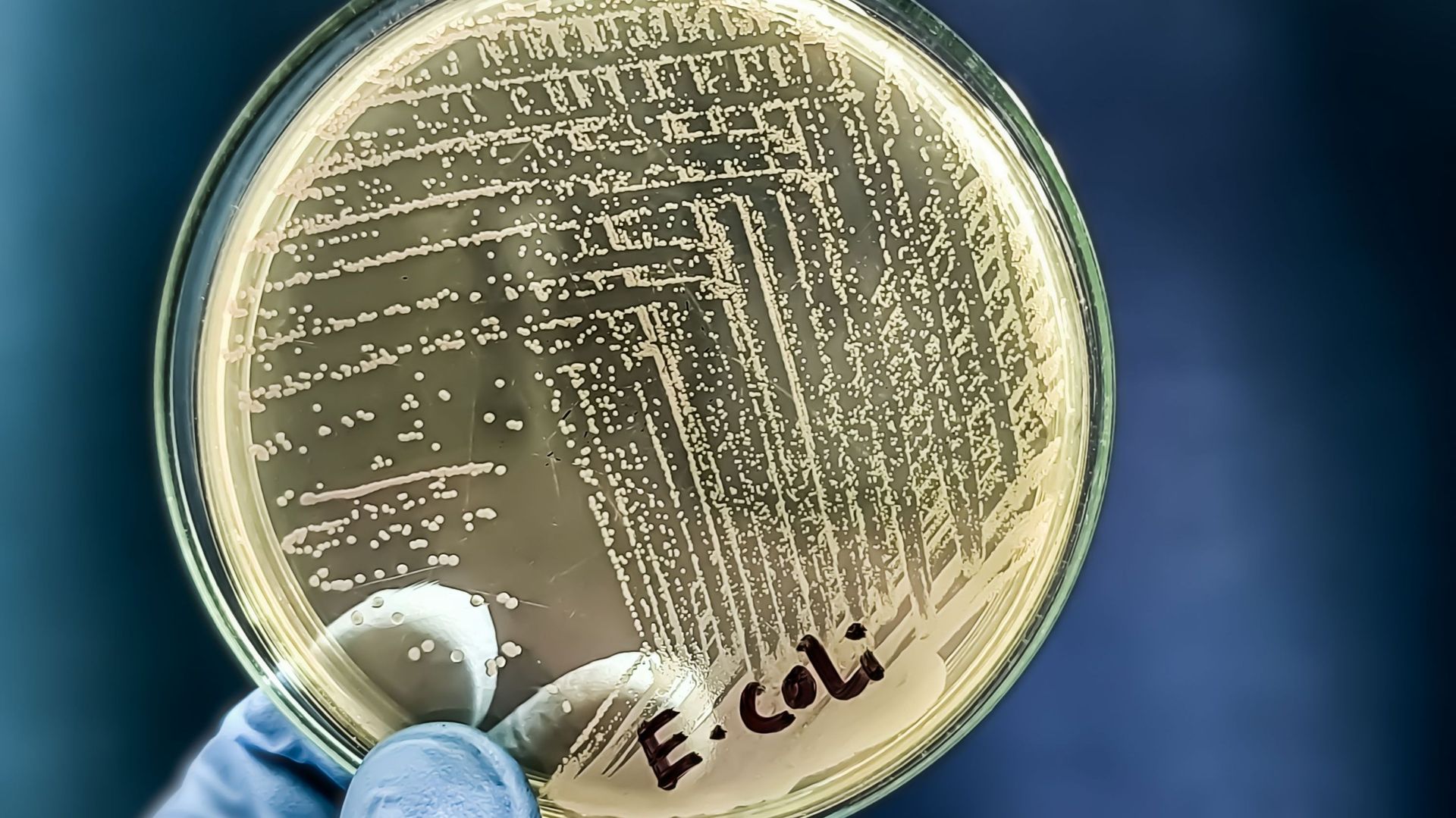 Infections dans les maisons de repos : qu'est-ce que la bactérie Stec ? Quels sont ses symptômes ? Et comment éviter sa propagation ?