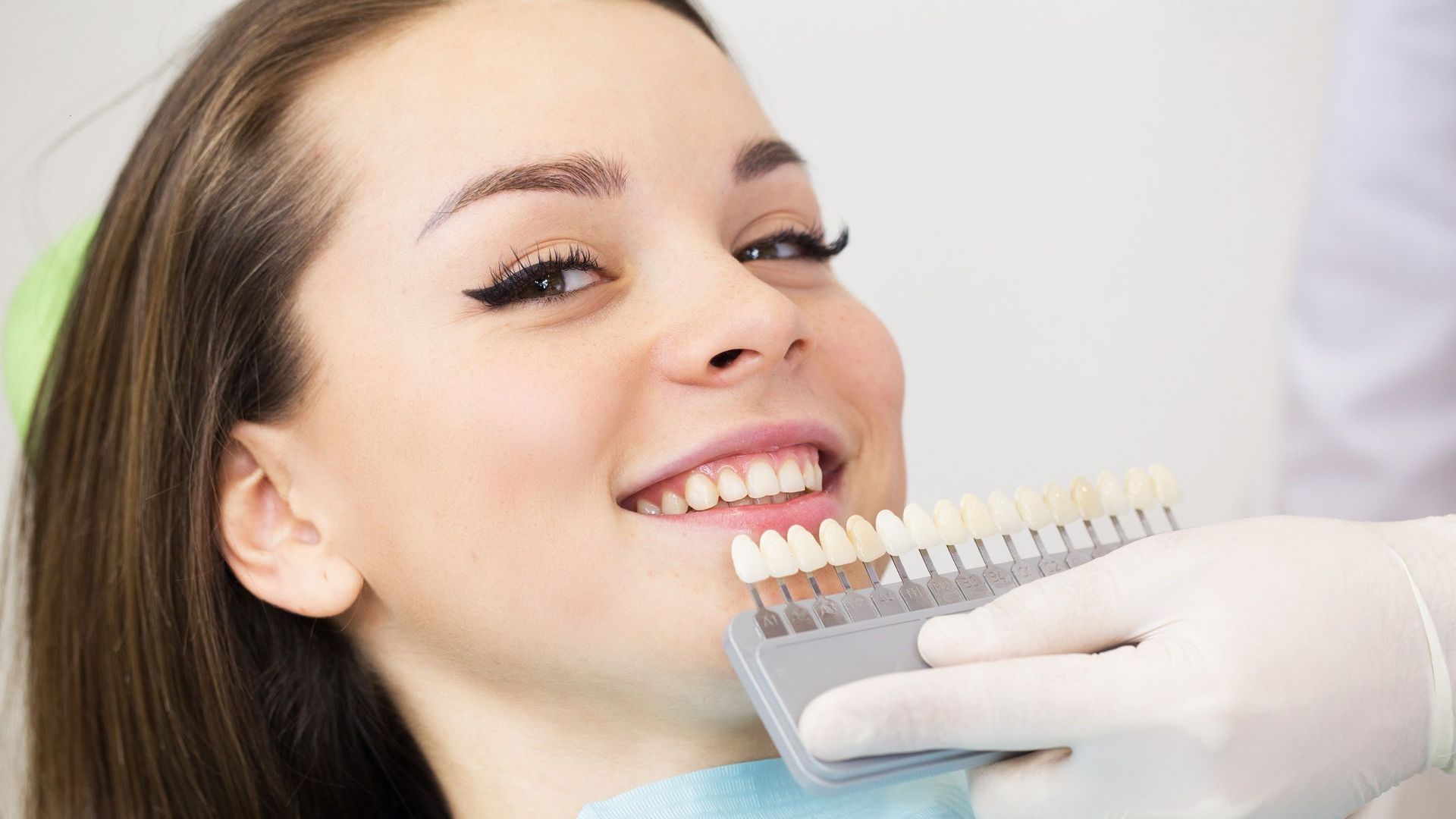 Les "facettes" dentaires, une pratique devenue virale qui n'est pas sans risque.