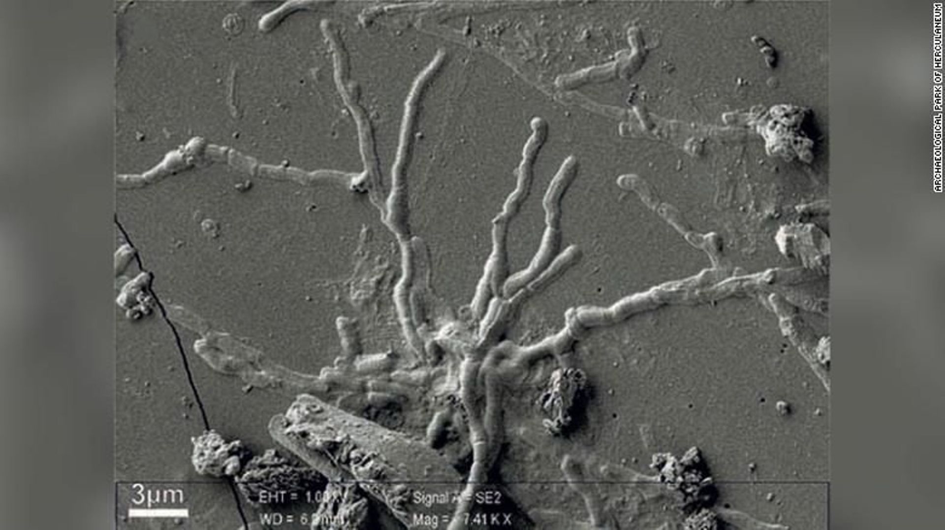 des-cellules-cerebrales-intactes-dans-le-crane-d-un-homme-tue-dans-l-eruption-du-vesuve-il-y-a-2000-ans