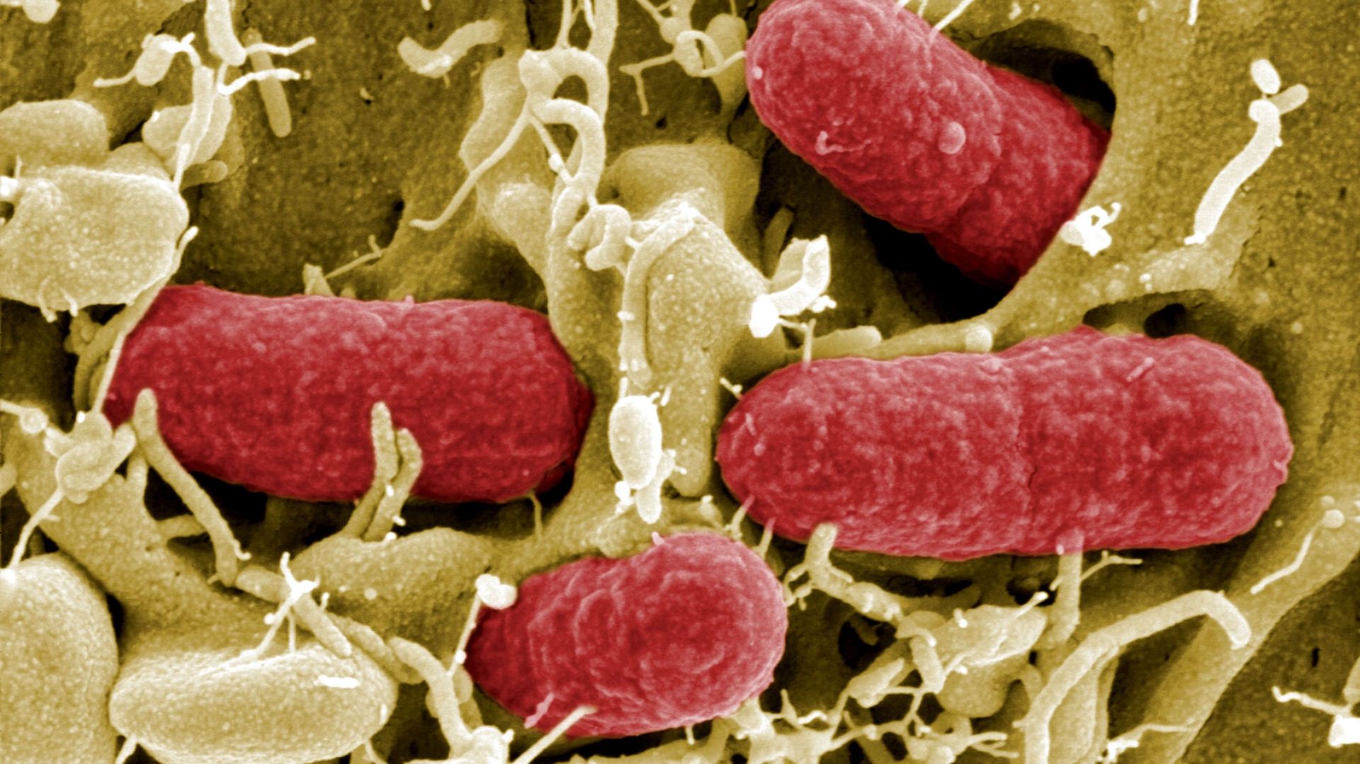 La bactérie escherichia coli enterohémorragique
