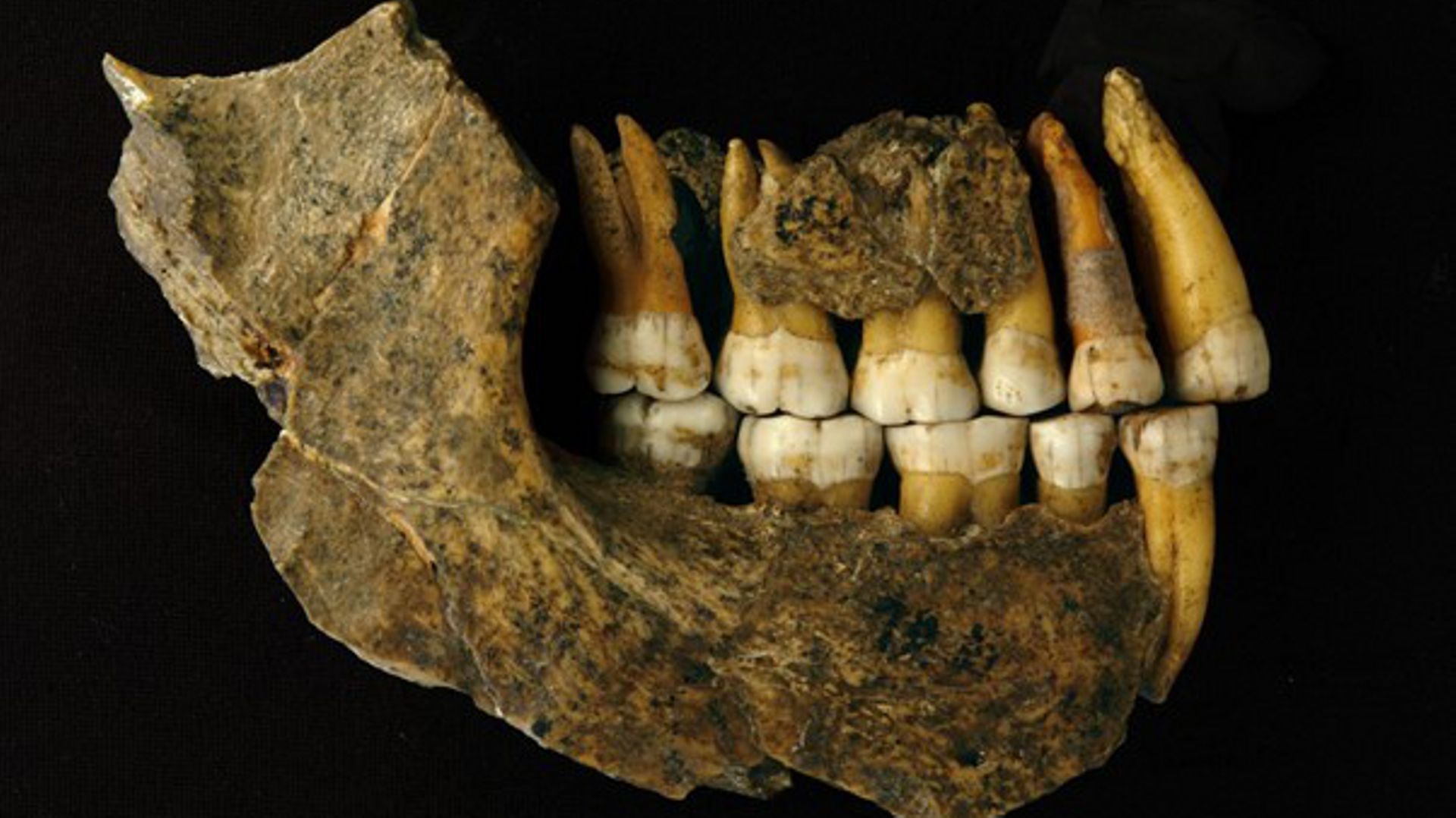Assemblage maxillaire et mandibule d’un Néandertalien tardif de la grotte de Spy