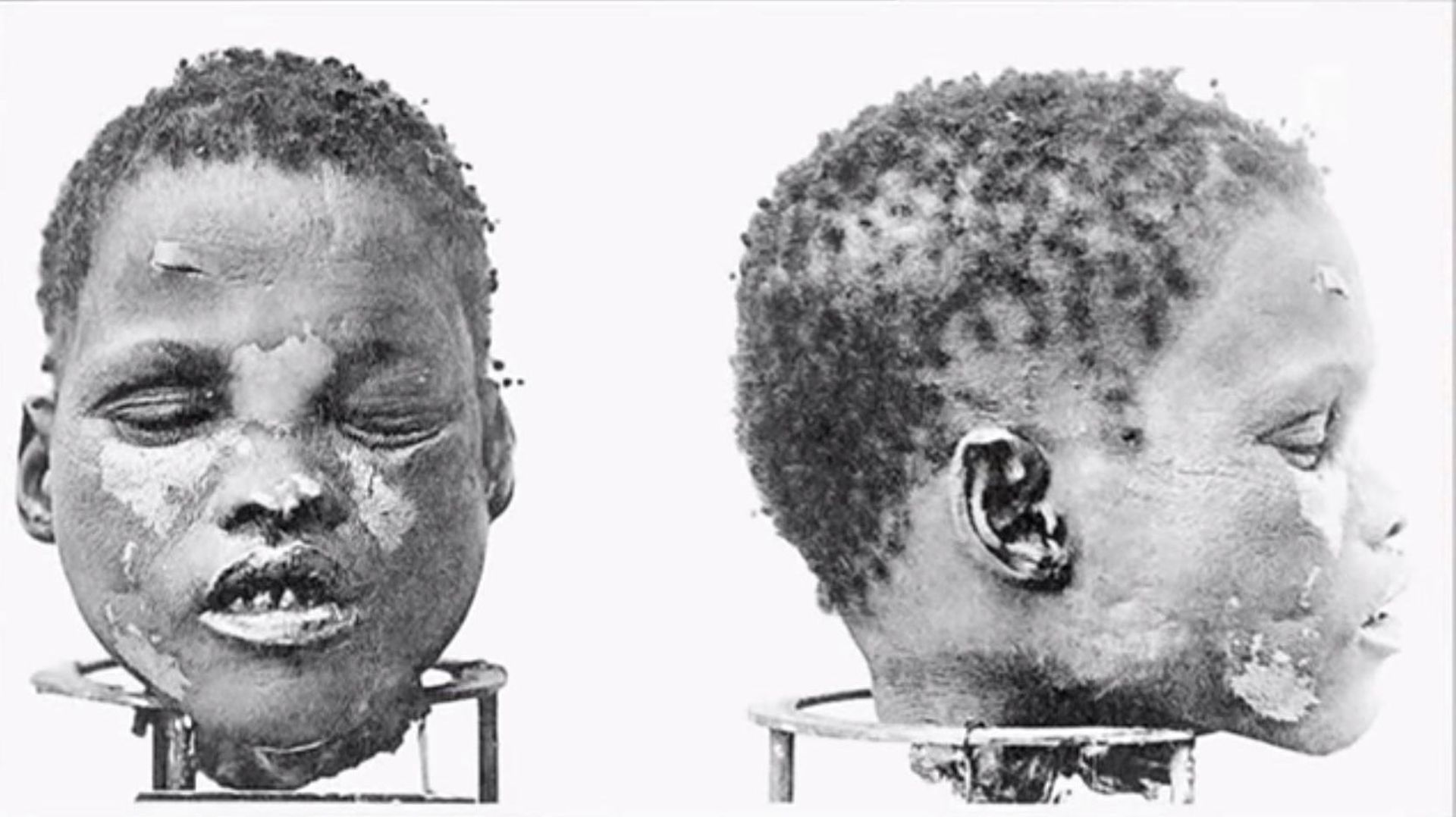 Un crâne de Herero, issu des massacres coloniaux allemands et utilisé ensuite par des laboratoires