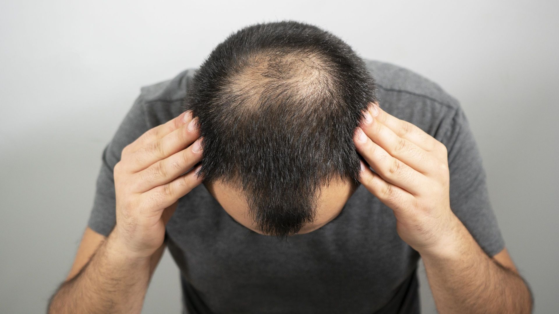 Présent dans les brocolis, le sulforaphane pourrait prévenir la chute de cheveux chez les hommes souffrant d’alopécie androgénétique.