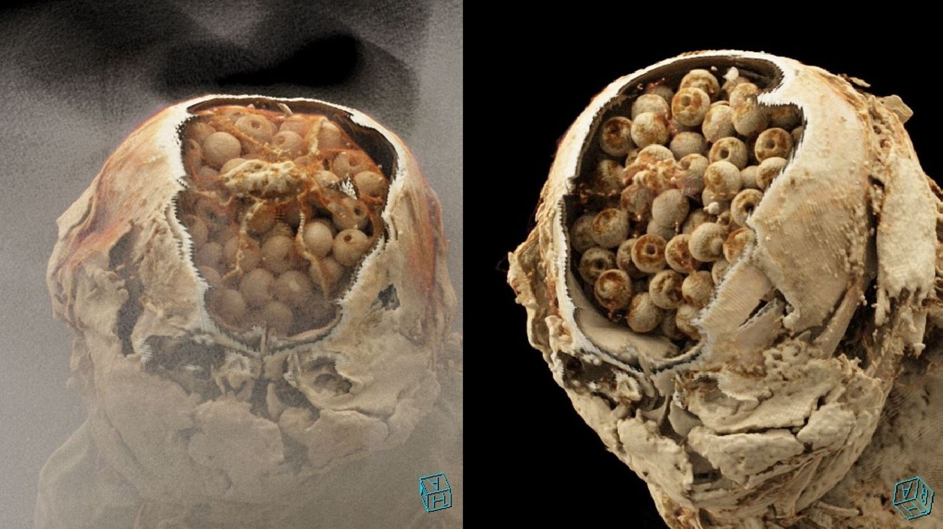 Des images 3d reconstituées à partir du scanner montrent la forme des billes contenues dans le crâne de la momie Inca.