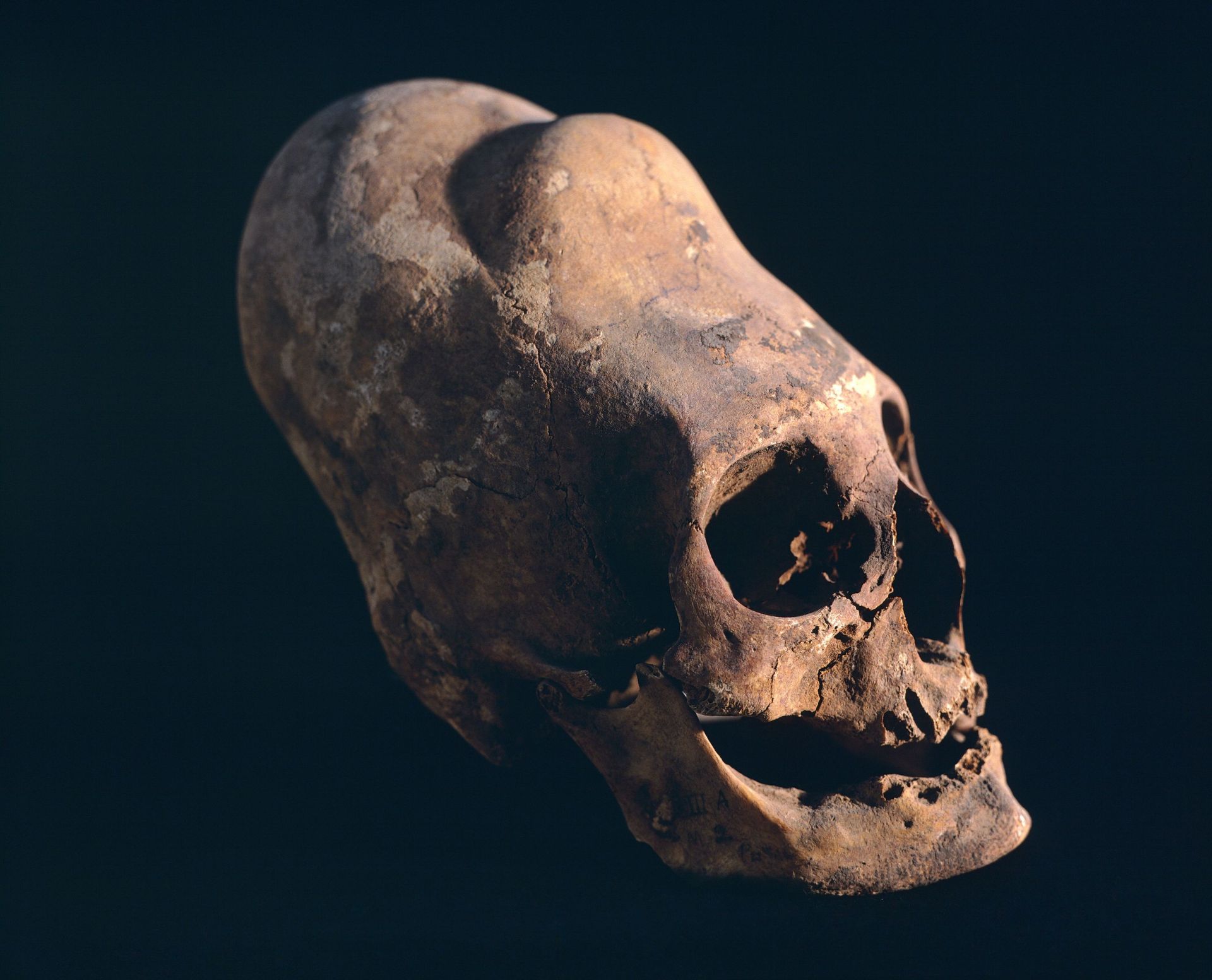 Crâne présentant une déformation crânienne typique. Objet provenant de la nécropole de Paracas (Pérou). Civilisation pré-incas de Paracas, vers le 10e siècle av. JC.