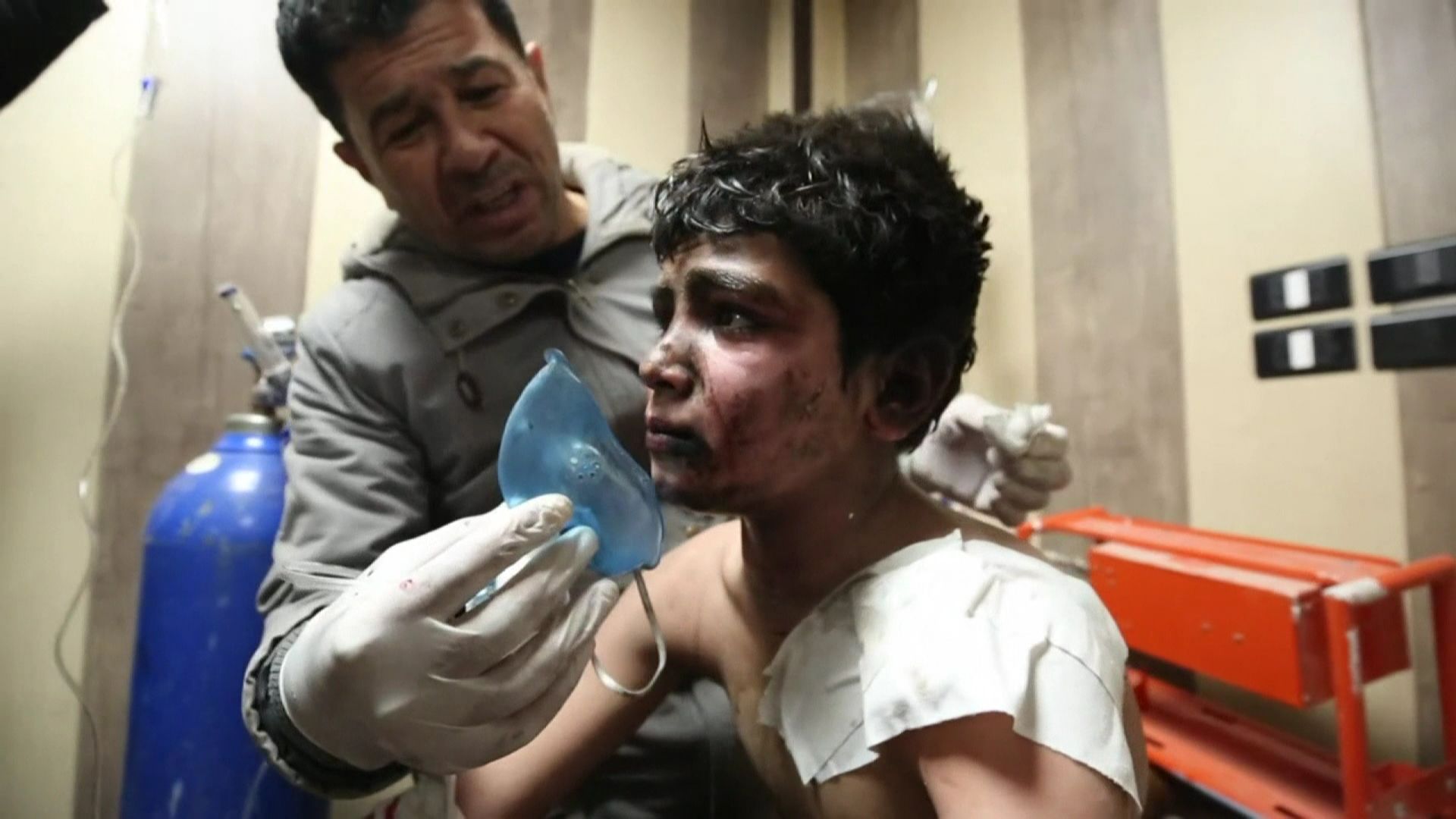 Un jeune garçon blessé dans un bombardement à Idlib.
