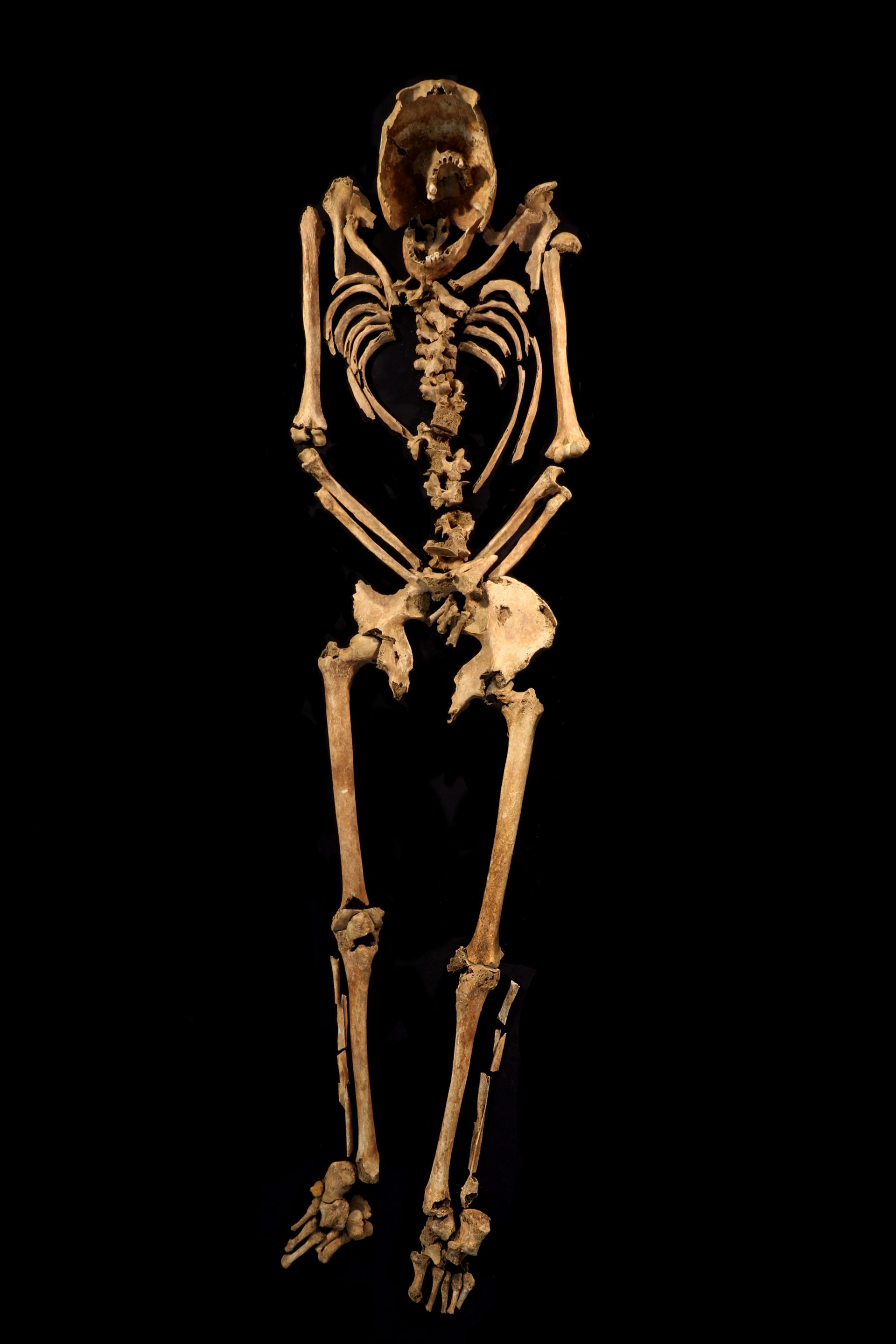 Le squelette du crucifié