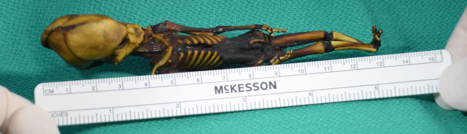 Cette image non datée, publiée avec l’autorisation du Dr Emery Smith, montre un minuscule squelette momifié découvert en 2003 dans le désert d’Atacama, au Chili, caché dans une pochette en cuir derrière une église.