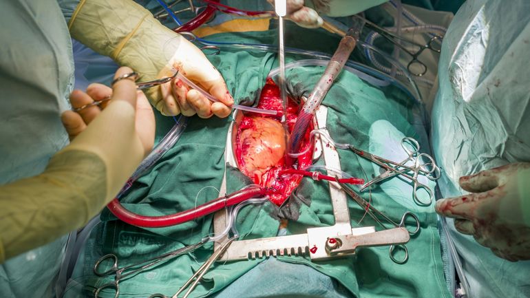 Le patient transplanté avec un coeur de porc a attrapé un virus typique chez cet animal