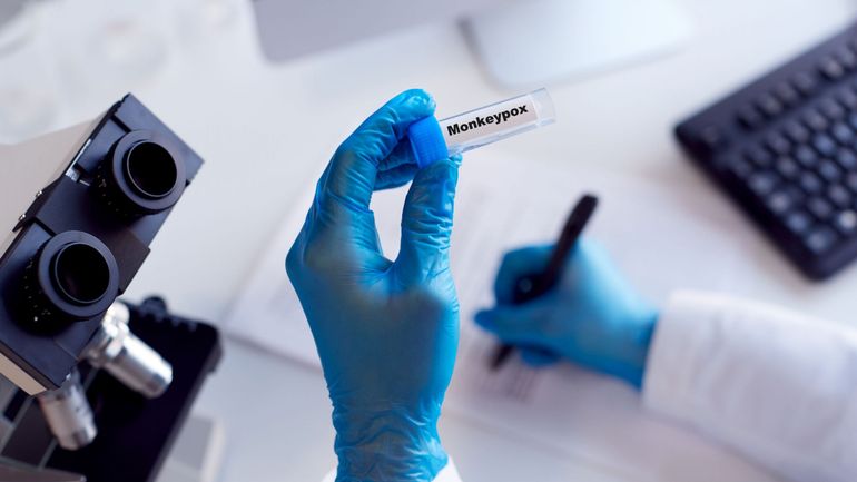 331 cas confirmés de variole du singe en Belgique, selon Sciensano