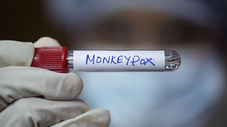 Le Sénégal prend des mesures contre la variole du singe après un cas détecté à Dakar