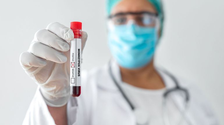 La Belgique compte désormais 24 cas d'infections par le virus de la variole du singe