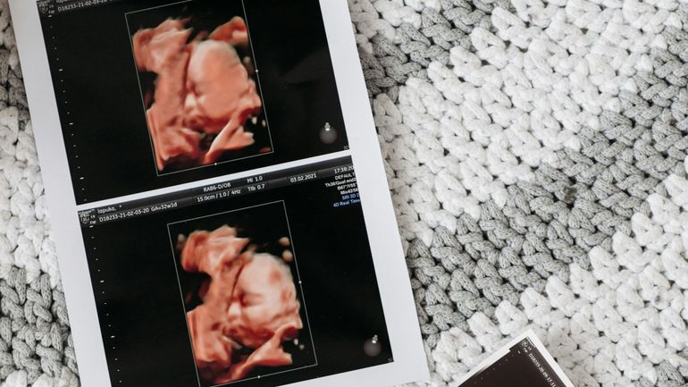 Une échographie comme souvenir de votre grossesse ? Est-ce dangereux ? Une Française vient d'être condamnée pour exercice illégal de la médecine