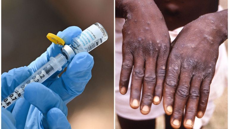 L'Afrique a besoin de davantage de vaccins contre le mpox, affirme MSF