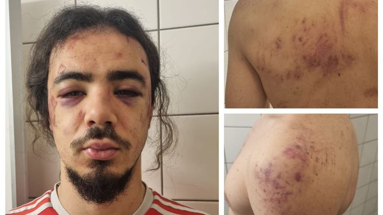 Un Anderlechtois frappe un policier confondu avec un voleur qui s'introduisait chez lui : 