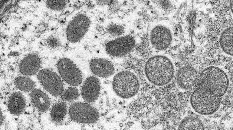 Variole du singe : près de 560 cas confirmés de variole du singe relayés vers l'OMS