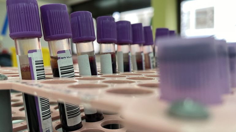 Lancement d'une étude européenne pour mieux connaître la variole du singe