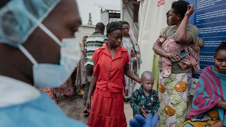 Santé : le virus mpox 