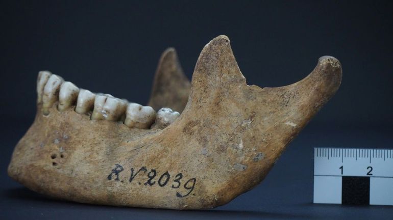 Archéologie et médecine : des chercheurs découvrent la 1re victime connue de la peste, il y a 5000 ans