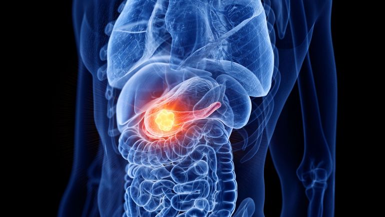 La VUB fait une découverte importante dans la recherche sur le cancer du pancréas