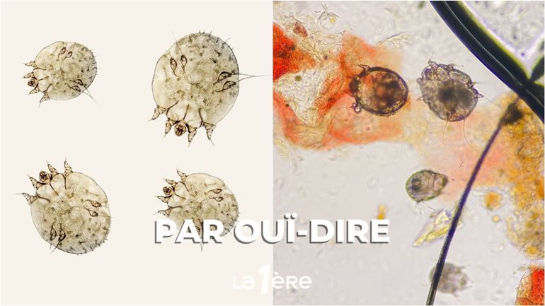 La gale, une vieille maladie en recrudescence ? Enquête dans "Le parasite et son hôte"