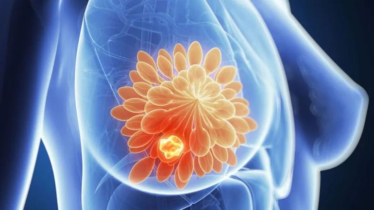 Chirurgie mammaire : l’avenir incertain des cliniques satellites comme Libramont