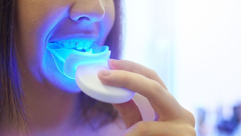 Blanchiment dentaire : cette astuce vue 19 millions de fois sur TikTok  affole les dentistes