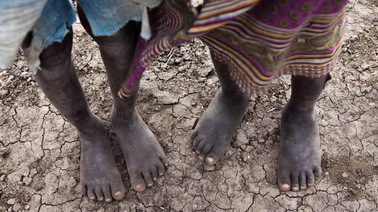 Plus de 18,4 millions de personnes menacées par la faim dans la Corne de l'Afrique, selon l'ONU