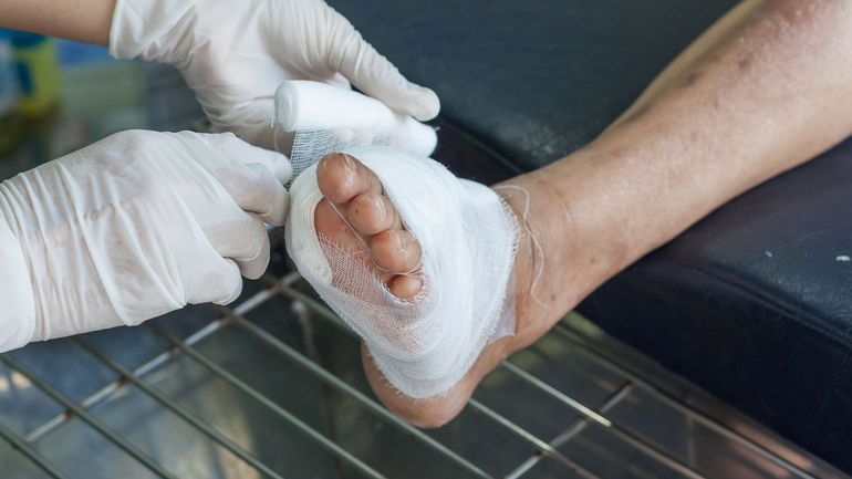 Santé : pourrait-on éviter d'avantage d'amputations du pied chez les personnes diabétiques ?