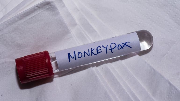 La ville de New York demande de rebaptiser la variole du singe, un nom jugé stigmatisant
