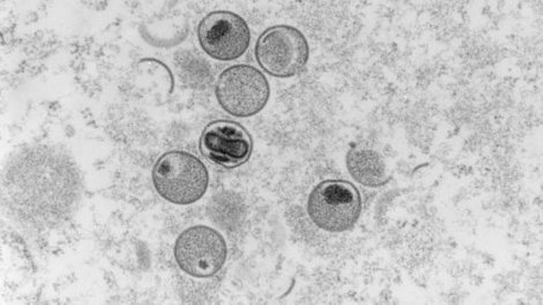 Une étude révèle que le virus de la variole du singe mute plus rapidement qu'escompté