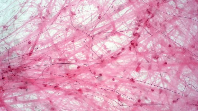 La VUB va tenter une greffe pour rendre leur fertilité à des hommes traités pour un cancer
