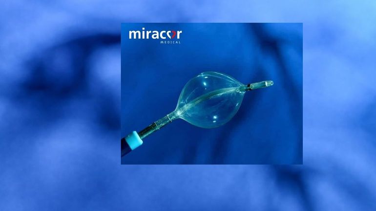 La société liégeoise Miracor autorisée à tester aux Etats-Unis son ballonnet contre les séquelles d'infarctus