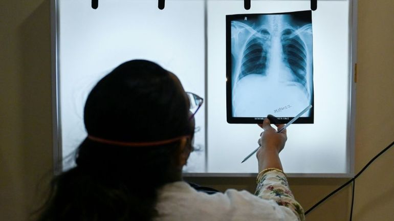 La tuberculose prospère à nouveau, s'inquiète l'OMS