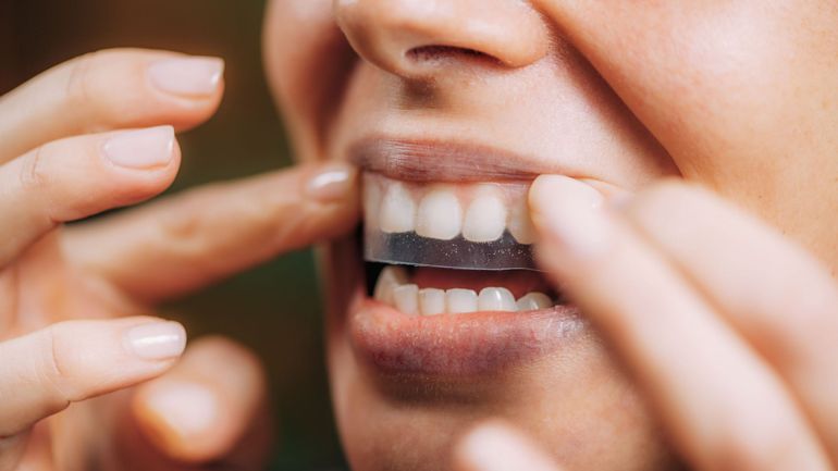 Bandes blanchissantes pour les dents : on a voulu tester… et on a vite regretté